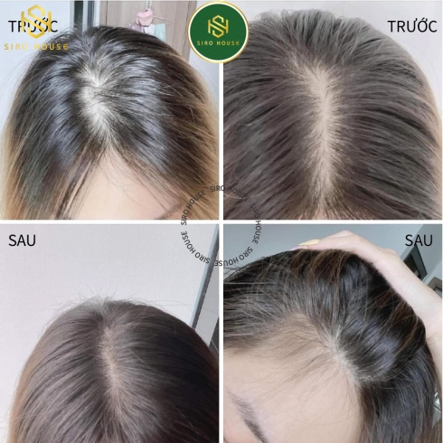Xịt Mọc Tóc MINOXIDIL BAILLEUL 2%