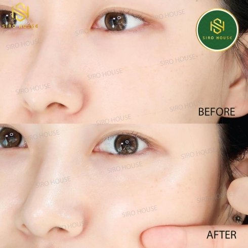 Kem Dưỡng Ẩm Sáng Da Và Phục Hồi Da La BONITA Vital Hyaluronic Acid Cream