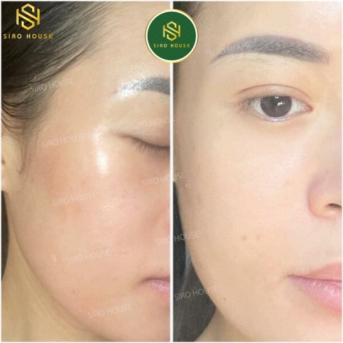 Serum Tái Tạo tế bào gốc SkinClinic P.R.P 30ml
