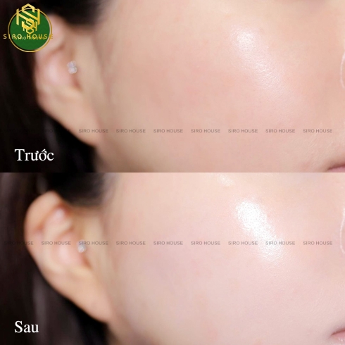 Mặt Nạ Phục Hồi, Cấp Ẩm Đa Tầng YỤEIN Liposome PP Mask 25ml 