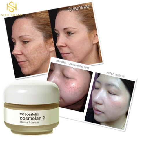 Kem Trị Nám MESEOSTETIC Cosmelan 2 30g