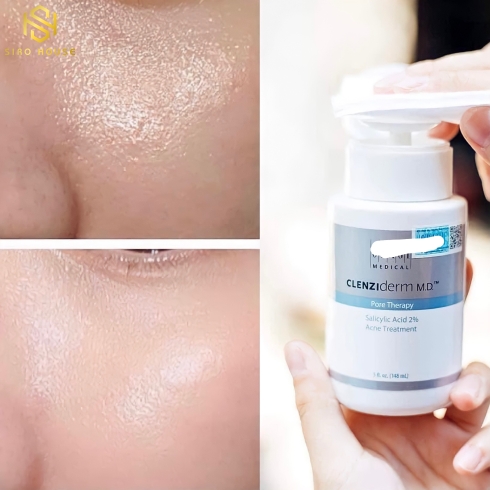  Lotion BHA trị mụn, giảm nhờn LCL PORE THERAPY OBAGI CLENZIDERM M.D BHA 2% 148ML