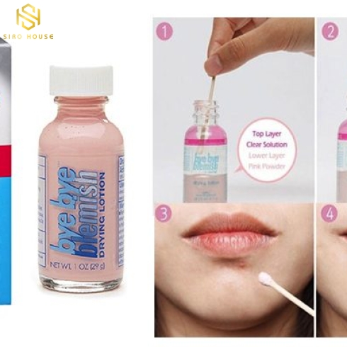 Chấm xẹp mụn cấp tốc Bye Bye Blemish