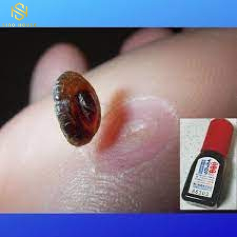 THUỐC CHẤM ĐIỀU TRỊ MỤN CÓC IBOKORORI 10ml 