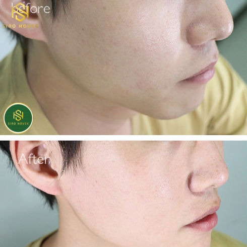 Kem dưỡng ẩm BABE Stop Akin Hidratante Matificante 50mL