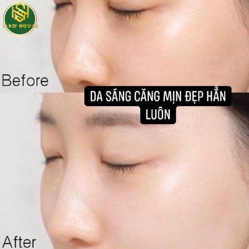 Set kem chống nắng + Xịt khoáng CNP Laboratory