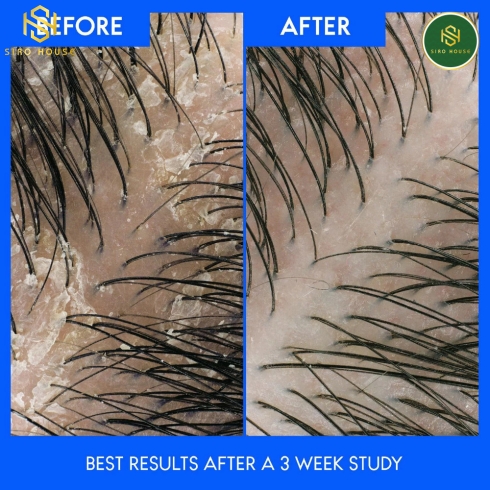 Dầu gội xả HEAD & SHOULDERS 2in1