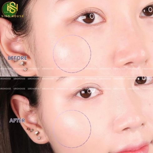 Kem Chống Nắng NEORETIN Discrom Control SPF50 40ml 