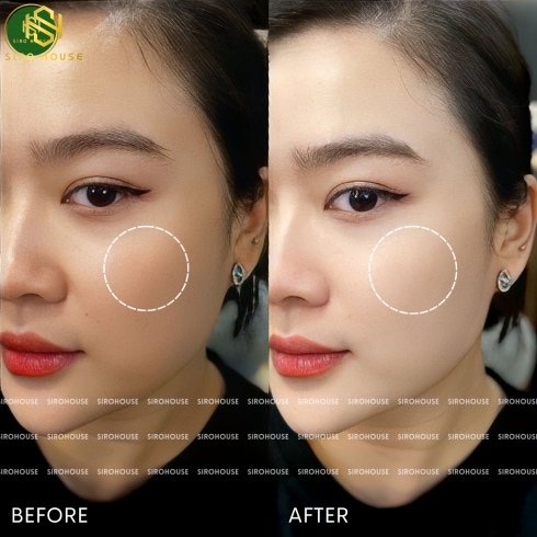 Kem dưỡng ban ngày nâng tone KYUNGLAB Day Cream 45% All Skin Types 50mL
