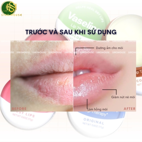 Sáp dưỡng môi VASELINE Lip Therapy  hộp thiếc 20g.
