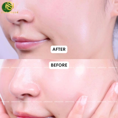 Kem dưỡng ẩm CLINIQUE Moisture Surge 100H 200mL