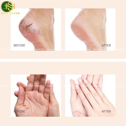 Dưỡng đa năng keo ong CNP Laboratory Propolis Multi Ampule Balm 7g
