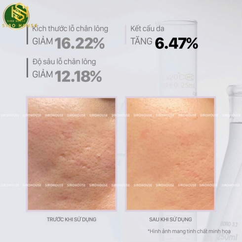 Tinh chất hỗ trợ tái sinh CNP Pdrn Derma Answer Active Boost Ampule 15mL