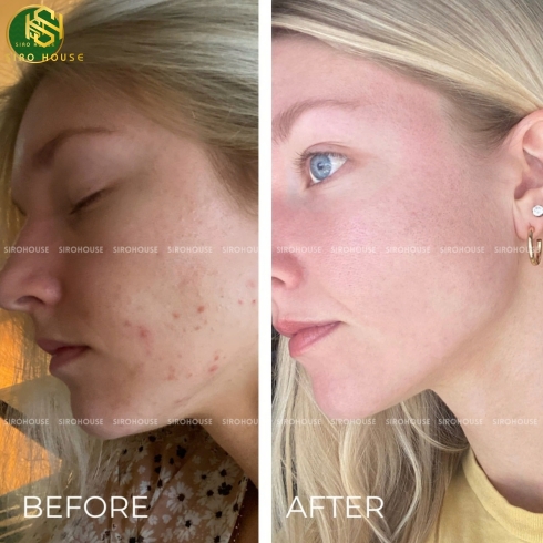 Viên uống sáng da mờ nám HUSH & HUSH SkinCapsule Brighten+ 60 viên
