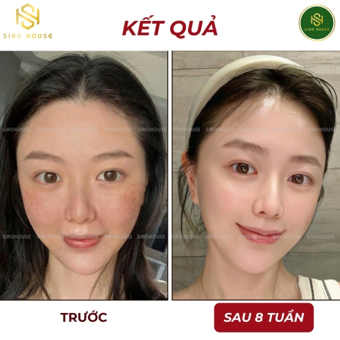 Kem dưỡng OLAY Niacinamide AHA Moisturiser 50g